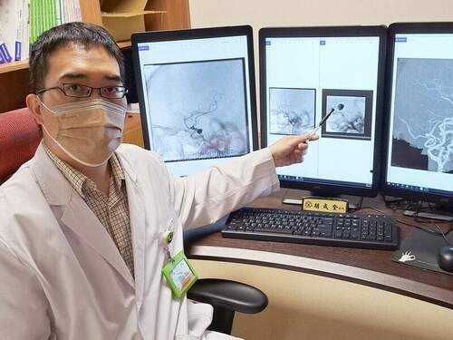急性腦出血-微創手術解危機-醫：早期發現預後佳