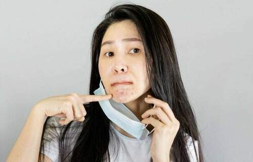口罩或將解封害怕沒臉見人？-小心機及早使用肌膚保養品