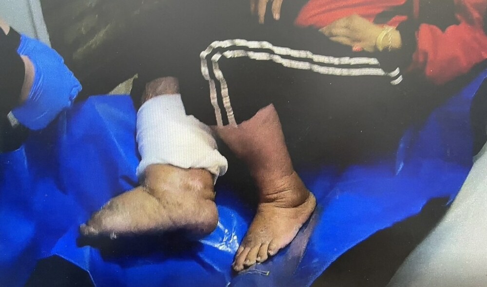 受困樓梯半天！5旬婦腿腫痛無法返家 中壢警消合力抬上樓 - 台北郵報 | The Taipei Post