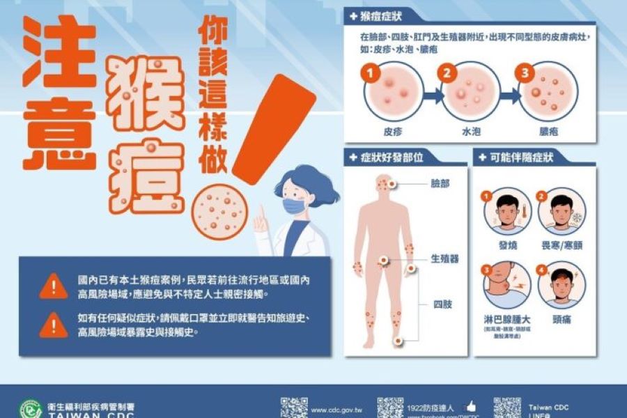 猴痘增20例創單周新高　國內累計破百病例 - 台北郵報 | The Taipei Post