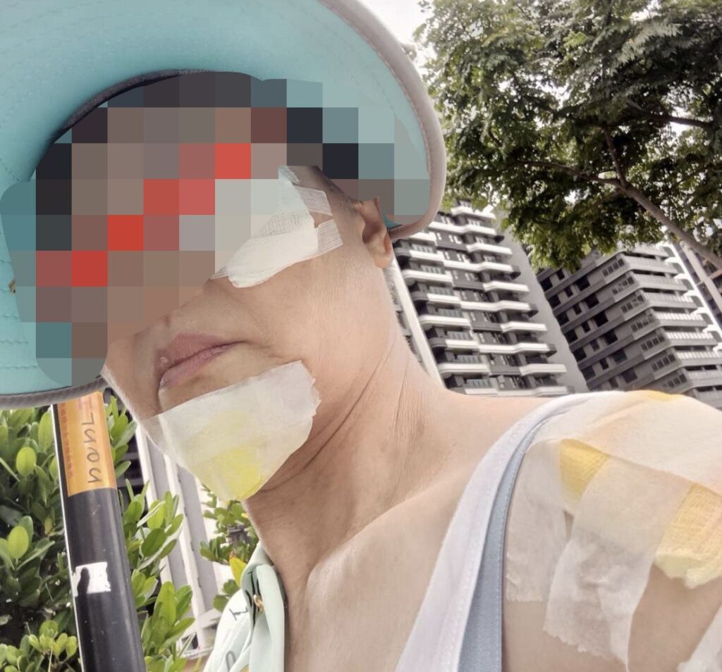 桃園文化局說明婦人摔傷事件-持續協調理賠積極處理